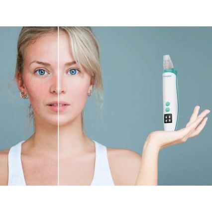 Beper - Pulitore dei pori ricaricabile USB/5V 400 mAh