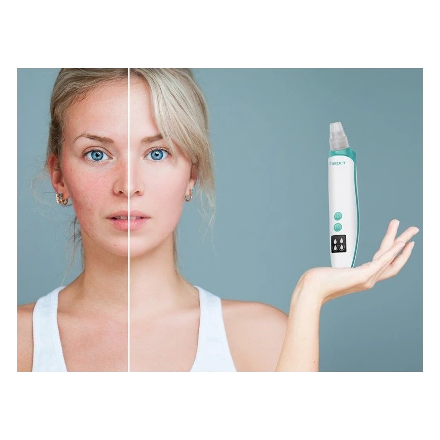 Beper - Pulitore dei pori ricaricabile USB/5V 400 mAh