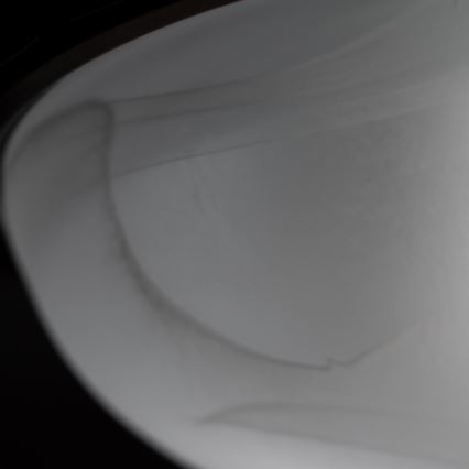 BRILAGI - Plafoniera da soffitto FRESCO 2xE27/40W/230V Ø 30 cm finitura rame
