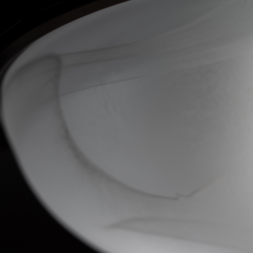 BRILAGI - Plafoniera da soffitto FRESCO 2xE27/40W/230V Ø 30 cm finitura rame